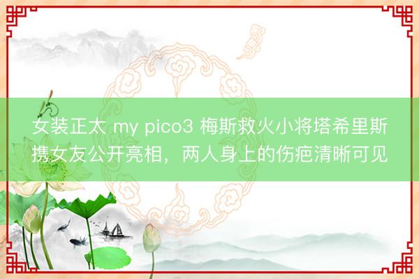 女装正太 my pico3 梅斯救火小将塔希里斯携女友公开亮相，两人身上的伤疤清晰可见